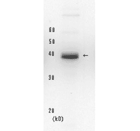 Western blot of endogenous XPA protein. Hela cell whole extract (20µg). Anti-XPA Antibody was used at 1:2,000 dilution. Goat Anti-Mouse IgG Antibody (HRP) was used as a secondary at 1:20,000 dilution.