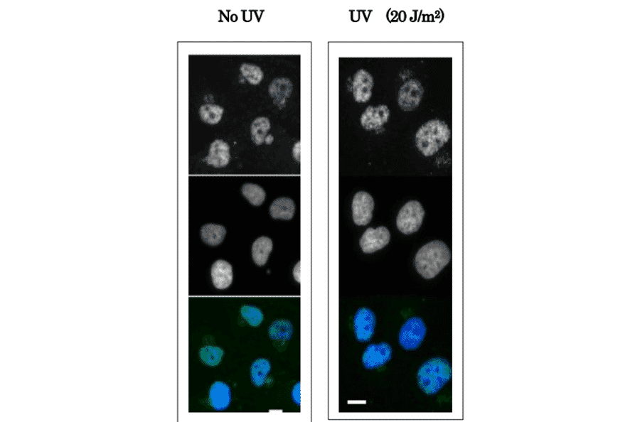 Immunofluorescence staining of human fibroblast cells (GM0637) using Anti-XPA Antibody. The cells were non-irradiated (left) or irradiated with UV at 20 J/m2 and fixed after 30 min with paraformaldehyde. Anti-XPA Antibody was used at 1:100 dilution and Goat Anti-Mouse IgG (Alexa 448) was used as a secondary at 1:5,000 dilution.