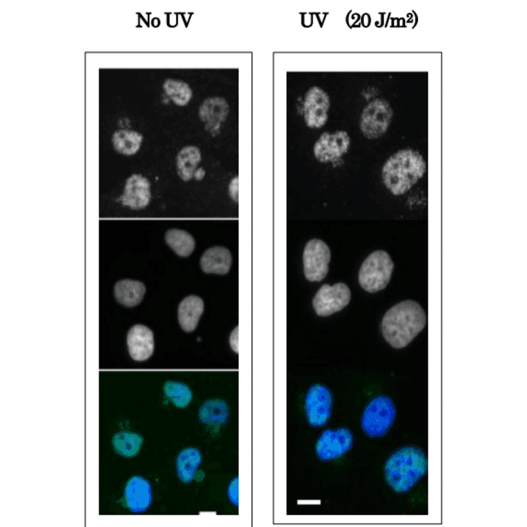 Immunofluorescence staining of human fibroblast cells (GM0637) using Anti-XPA Antibody. The cells were non-irradiated (left) or irradiated with UV at 20 J/m2 and fixed after 30 min with paraformaldehyde. Anti-XPA Antibody was used at 1:100 dilution and Goat Anti-Mouse IgG (Alexa 448) was used as a secondary at 1:5,000 dilution.