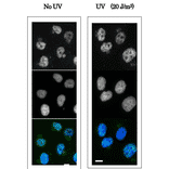 Immunofluorescence staining of human fibroblast cells (GM0637) using Anti-XPA Antibody. The cells were non-irradiated (left) or irradiated with UV at 20 J/m2 and fixed after 30 min with paraformaldehyde. Anti-XPA Antibody was used at 1:100 dilution and Goat Anti-Mouse IgG (Alexa 448) was used as a secondary at 1:5,000 dilution.