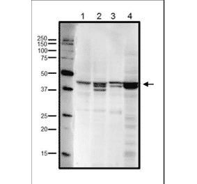 Western blot analysis of endogenous RRM2 in crude cell extracts. Lane 1: HeLa cells (20µg). Lane 2: MCF7 cells (20µg). Lane 3: NIH3T3 cells (20µg). Lane 4: Xenopus eggs at mitotic stage (20µg). Multiple bands are due to phosphorylation at Ser20 and/or Thr33 (human sequence). Anti-RRM2 Antibody was used at 1:1,000 dilution.