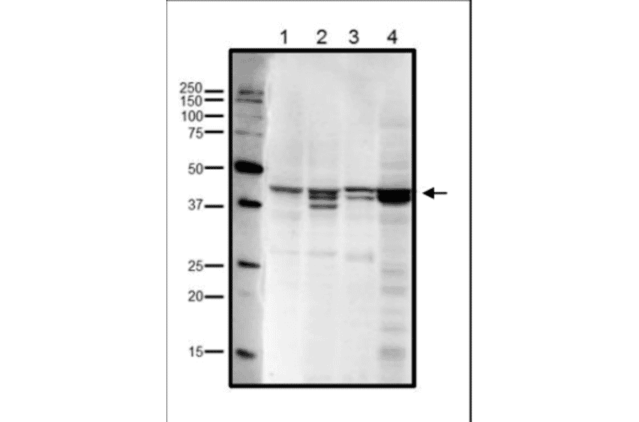 Western blot analysis of endogenous RRM2 in crude cell extracts. Lane 1: HeLa cells (20µg). Lane 2: MCF7 cells (20µg). Lane 3: NIH3T3 cells (20µg). Lane 4: Xenopus eggs at mitotic stage (20µg). Multiple bands are due to phosphorylation at Ser20 and/or Thr33 (human sequence). Anti-RRM2 Antibody was used at 1:1,000 dilution.