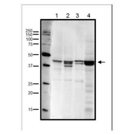 Western blot analysis of endogenous RRM2 in crude cell extracts. Lane 1: HeLa cells (20µg). Lane 2: MCF7 cells (20µg). Lane 3: NIH3T3 cells (20µg). Lane 4: Xenopus eggs at mitotic stage (20µg). Multiple bands are due to phosphorylation at Ser20 and/or Thr33 (human sequence). Anti-RRM2 Antibody was used at 1:1,000 dilution.