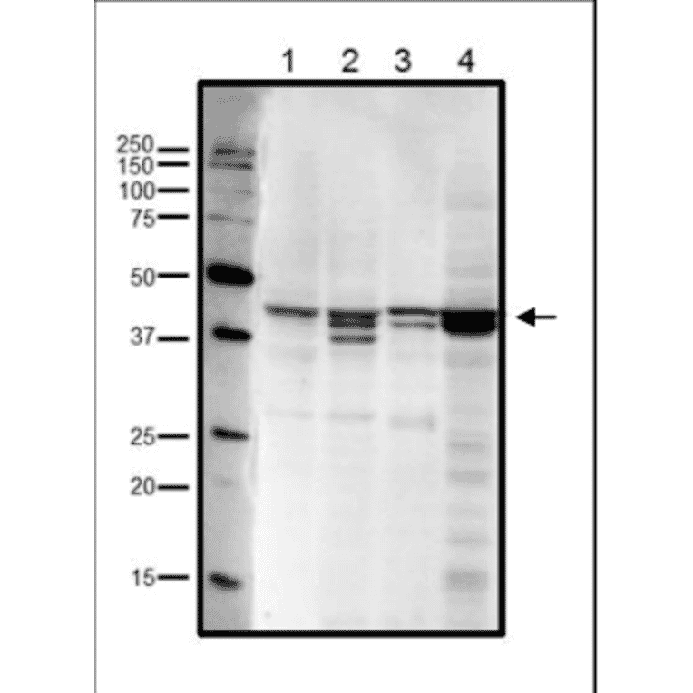 Western blot analysis of endogenous RRM2 in crude cell extracts. Lane 1: HeLa cells (20µg). Lane 2: MCF7 cells (20µg). Lane 3: NIH3T3 cells (20µg). Lane 4: Xenopus eggs at mitotic stage (20µg). Multiple bands are due to phosphorylation at Ser20 and/or Thr33 (human sequence). Anti-RRM2 Antibody was used at 1:1,000 dilution.