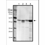 Western blot analysis of endogenous RRM2 in crude cell extracts. Lane 1: HeLa cells (20µg). Lane 2: MCF7 cells (20µg). Lane 3: NIH3T3 cells (20µg). Lane 4: Xenopus eggs at mitotic stage (20µg). Multiple bands are due to phosphorylation at Ser20 and/or Thr33 (human sequence). Anti-RRM2 Antibody was used at 1:1,000 dilution.