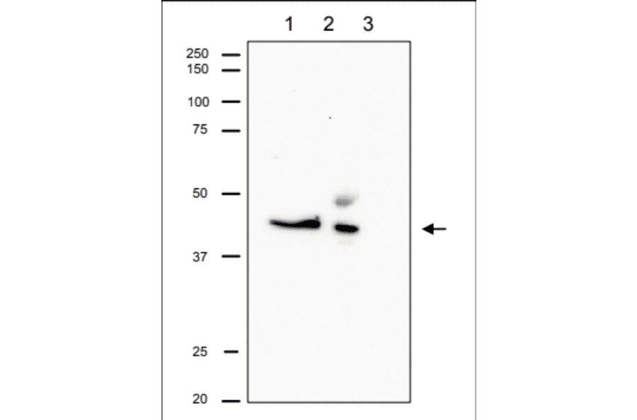 Immunoprecipitation of RRM2 from CHO cells. Lane 1: Crude extract of CHO cells. Lane 2: The immunoprecipitate with Anti-RRM2 Antibody at 1:1,000 dilution. Lane 3: Supernatant of immunoprecipitation. The upper band in Lane 2 is IgG heavy chain. Anti-RRM2 Antibody was used at 1:500 dilution.