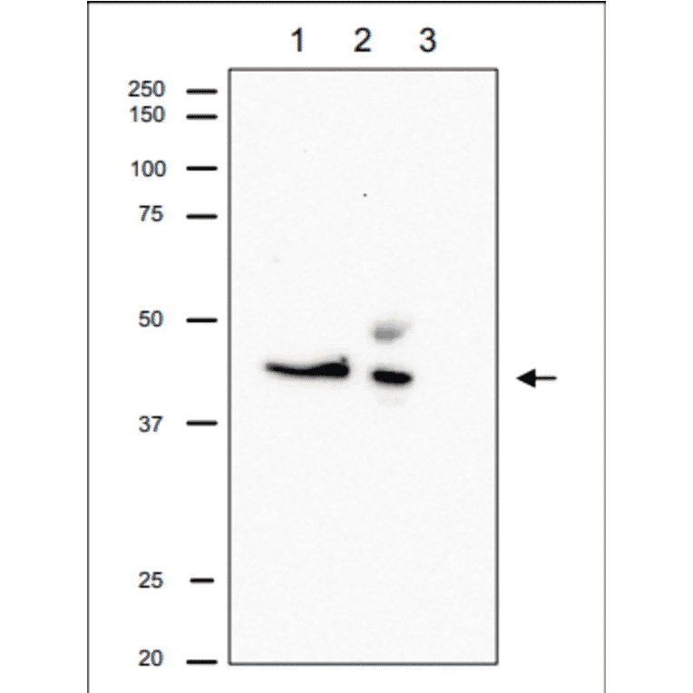 Immunoprecipitation of RRM2 from CHO cells. Lane 1: Crude extract of CHO cells. Lane 2: The immunoprecipitate with Anti-RRM2 Antibody at 1:1,000 dilution. Lane 3: Supernatant of immunoprecipitation. The upper band in Lane 2 is IgG heavy chain. Anti-RRM2 Antibody was used at 1:500 dilution.