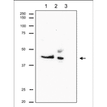 Immunoprecipitation of RRM2 from CHO cells. Lane 1: Crude extract of CHO cells. Lane 2: The immunoprecipitate with Anti-RRM2 Antibody at 1:1,000 dilution. Lane 3: Supernatant of immunoprecipitation. The upper band in Lane 2 is IgG heavy chain. Anti-RRM2 Antibody was used at 1:500 dilution.