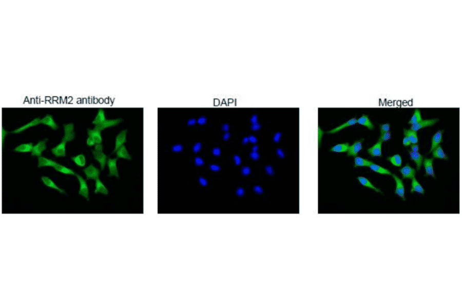Immunofluorescence staining of RRM2 protein in MCF cells with Anti-RRM2 Antibody. MCF7 cells were fixed with 4% PFA and permeabilized with 0.25% TritonX 100 and reacted with Anti-RRM2 Antibody at 1:100 dilution. Anti-Rabbit IgG Antibody (Alexa Fluor 488) was used as the secondary at 1:1,000 dilution. DNA was stained with 1.0µg/mL DAPI in TBS.