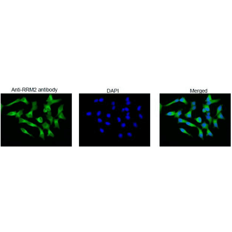 Immunofluorescence staining of RRM2 protein in MCF cells with Anti-RRM2 Antibody. MCF7 cells were fixed with 4% PFA and permeabilized with 0.25% TritonX 100 and reacted with Anti-RRM2 Antibody at 1:100 dilution. Anti-Rabbit IgG Antibody (Alexa Fluor 488) was used as the secondary at 1:1,000 dilution. DNA was stained with 1.0µg/mL DAPI in TBS.