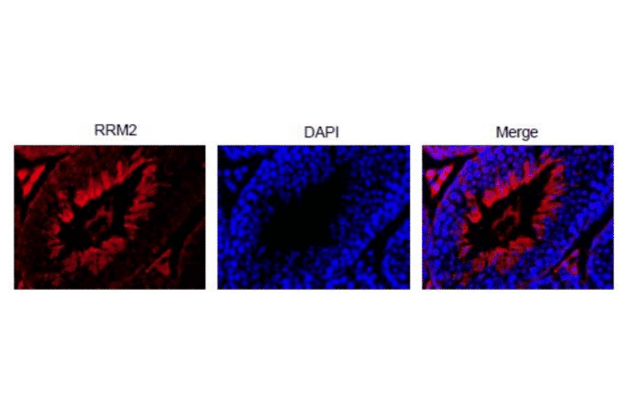 Immunohistochemical staining of RRM2 in mouse testis with Anti-RRM2 Antibody. Section of formalin-fixed and paraffin embedded mouse testis was reacted with Anti-RRM2 Antibody at 1:300 dilution. Nuclear DNA was stained with DAPI (center) and merged image is shown on left. RRM2 is abundantly expressed in actively proliferating cells.