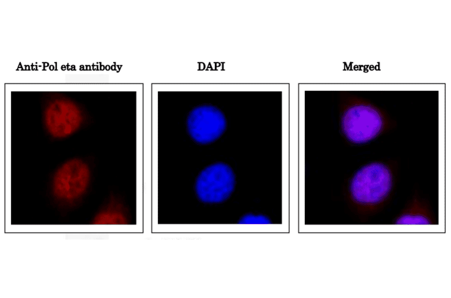 Immunofluorescence staining of DNA polymerase eta in HeLa cells with Anti-DNA polymerase eta Antibody. HeLa cells were fixed in 4% paraformaldehyde overnight and permeabilized in 0.25% TritonX 100 in PBS for 10 min. Anti-DNA polymerase eta Antibody was used at 1:1,000 dilution.