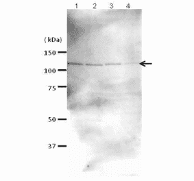 Western blot analysis of Rad21 in the whole cell extracts