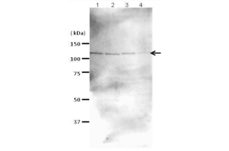 Western blot analysis of Rad21 in the whole cell extracts