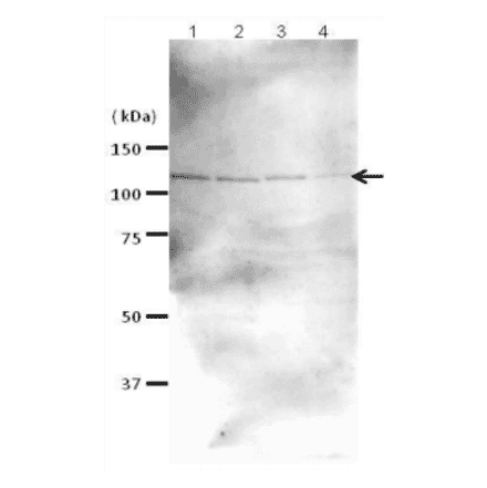 Western blot analysis of Rad21 in the whole cell extracts