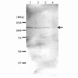 Western blot analysis of Rad21 in the whole cell extracts