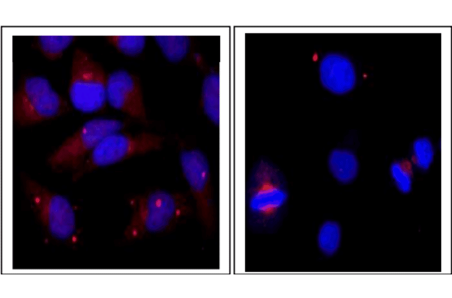 Immunofluorescence staining of centrin-1 protein in HeLa cells with anti-Centrin 1 antibody.