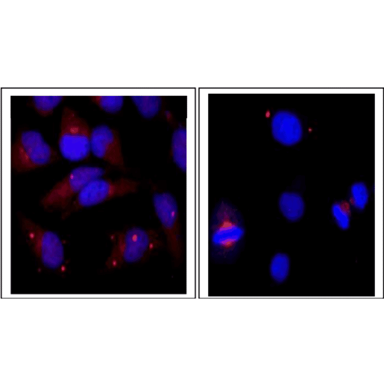 Immunofluorescence staining of centrin-1 protein in HeLa cells with anti-Centrin 1 antibody.