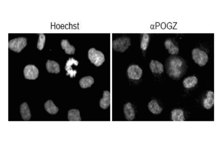 Immuno-fluorescence staining of POGZ.