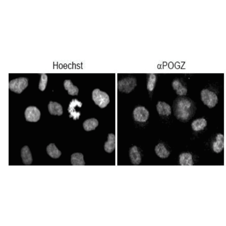 Immuno-fluorescence staining of POGZ.