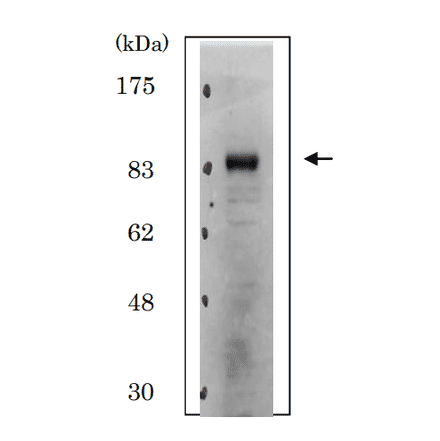 Identification of Cdt2 protein in whole cell extract of HeLa cells by western blotting