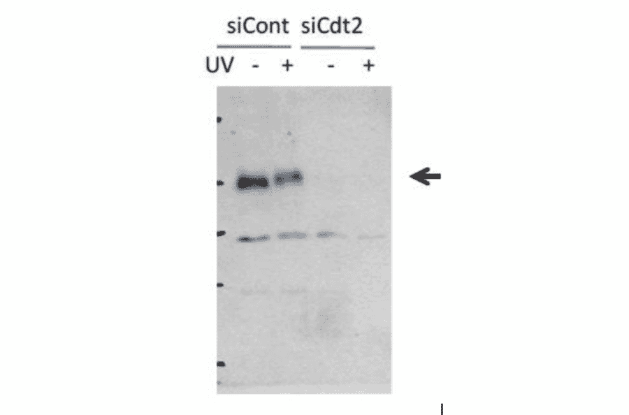Inhibition of Cdt2 protein synthesis by Cdt2 siRNA introduced into HeLa cells.