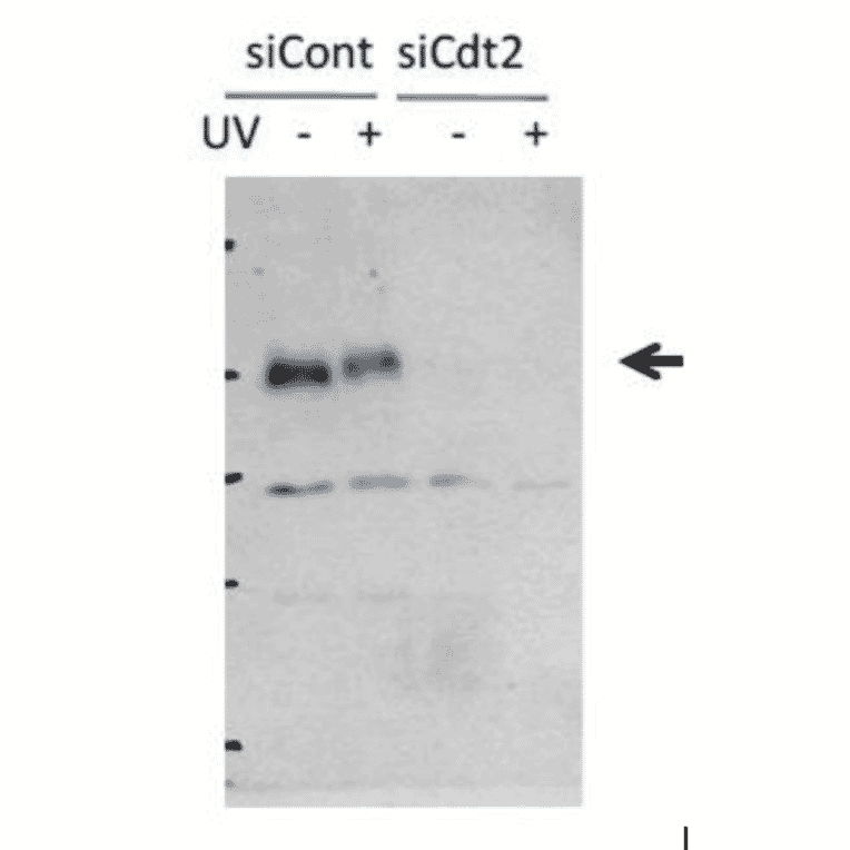 Inhibition of Cdt2 protein synthesis by Cdt2 siRNA introduced into HeLa cells.
