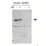 Inhibition of Cdt2 protein synthesis by Cdt2 siRNA introduced into HeLa cells.