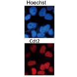 Immunofluorescence staining of Cdt2 protein in growing Hela cells with the antibody.