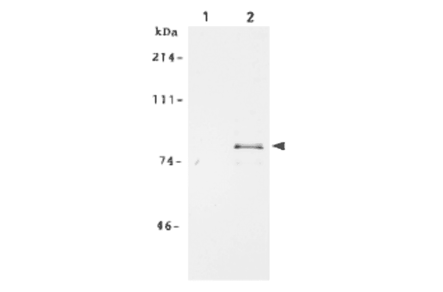 Immunoprecipitation of MCM7 protein from crude extract of human fibroblast cell line WI38 by using anti-MCM7 antibody.. Lane 1; Immunoprecipitation with pre-immune serum Lane 2; Immnoprecipitation with anti-MCM7 antiserum. Cells were labeled with S35 methionine and MCM7 was immunoprecipitated with the anti-MCM7 antibody followed by SDS-PAGE and autoradiography.
