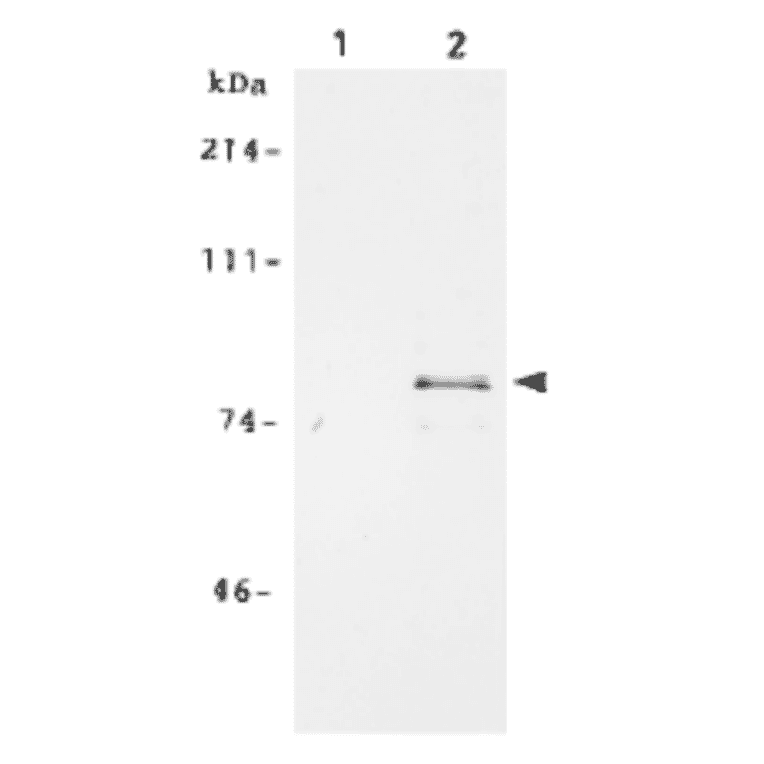Immunoprecipitation of MCM7 protein from crude extract of human fibroblast cell line WI38 by using anti-MCM7 antibody.. Lane 1; Immunoprecipitation with pre-immune serum Lane 2; Immnoprecipitation with anti-MCM7 antiserum. Cells were labeled with S35 methionine and MCM7 was immunoprecipitated with the anti-MCM7 antibody followed by SDS-PAGE and autoradiography.