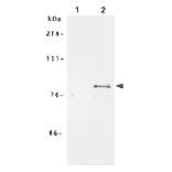 Immunoprecipitation of MCM7 protein from crude extract of human fibroblast cell line WI38 by using anti-MCM7 antibody.. Lane 1; Immunoprecipitation with pre-immune serum Lane 2; Immnoprecipitation with anti-MCM7 antiserum. Cells were labeled with S35 methionine and MCM7 was immunoprecipitated with the anti-MCM7 antibody followed by SDS-PAGE and autoradiography.