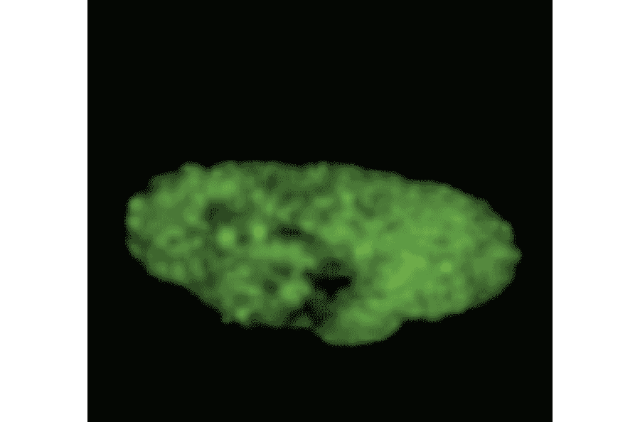 Immunofluorecence staining and confocal microscopic analysis of MCM7 in G1 phase HeLa cell nucleus by using anti-MCM7 antibody after treatment with protein cross-linking reagent, DSP and chromatin extraction. The processed cells were fixed with formaldehyde before staining.