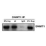 Immunoprecipitation of Dnmt1 from mouse MEL cells. 