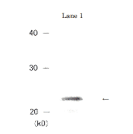 Detection of HP1a protein by Western blotting. 