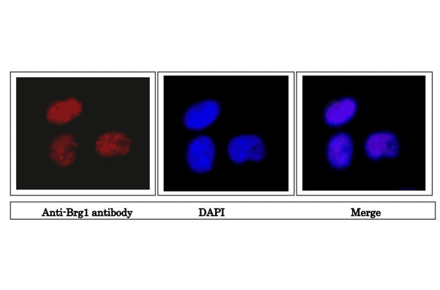 Immunofluorescence staining of Brg1 protein in HeLa cells. 