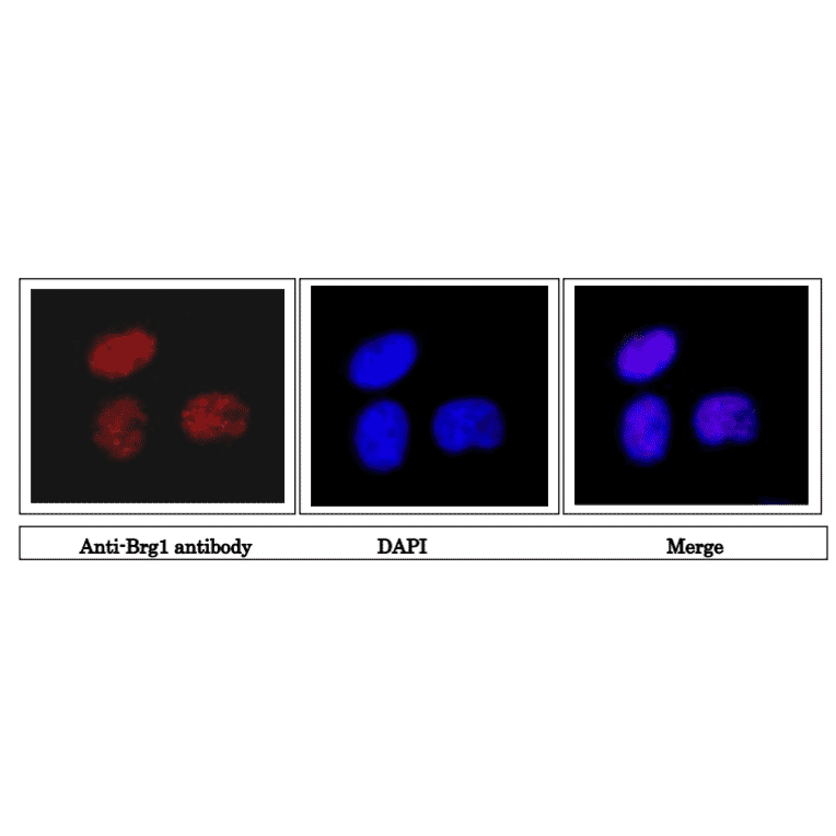 Immunofluorescence staining of Brg1 protein in HeLa cells. 