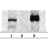 Immunoprecipitation of Brg1 protein from nuclear extracts of HeLa cells by using anti-Brg1 antibody. Brg1 was precipitated with anti-Brg1 antibody and proteinG-conjugated agarose beads and probed with anti-Brg1 antibody by western blotting.. Lane1; Input nuclear extracts Lane 2; Control IP with non-immune IgG Lane 3; Immunoprecipitation with anti-Brg1 antibody