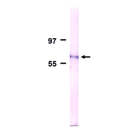 Detection of Nup62 in membrane fraction of HeLa cells by Western blotting with the antibody 2A.