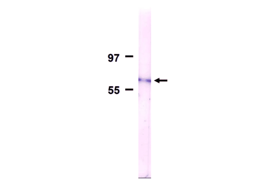 Detection of Nup62 in membrane fraction of HeLa cells by Western blotting with the antibody 2A.