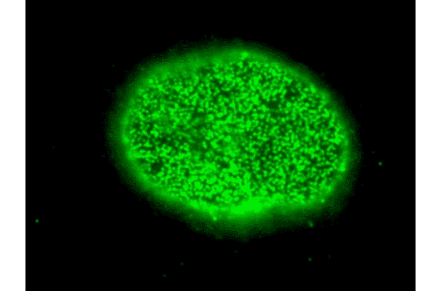 Immunofluorescent staining of HeLa cells with the antibody 2A, focused on nuclear surface