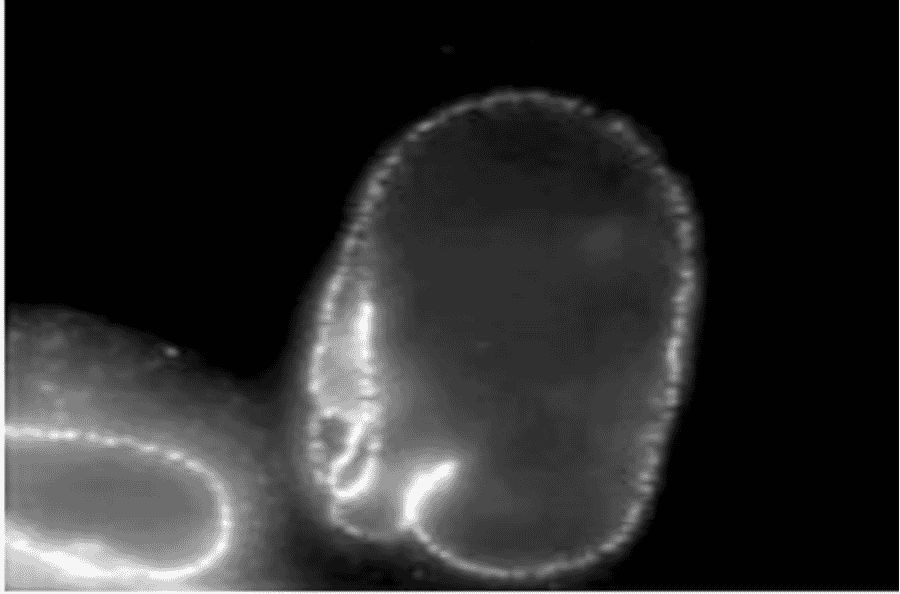 Immunofluorescent staining of HeLa cells with the antibody 2A, focused on nuclear rim