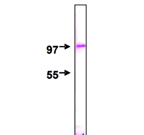 Detection of Nup98 protein by Western blotting using this antibody, 2H10. The sample is HeLa nuclear membrane fraction. The IgG was diluted 2,000 fold before use.