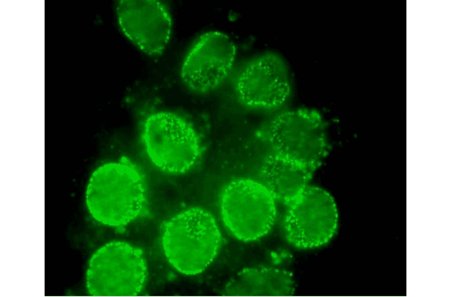 Immunofluorescent staining of rat neuron with antibody 2H10. The dots are Nup98.