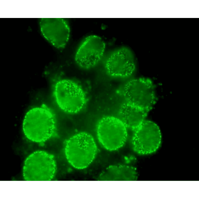 Immunofluorescent staining of rat neuron with antibody 2H10. The dots are Nup98.