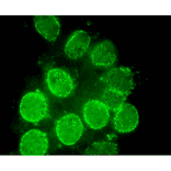 Immunofluorescent staining of rat neuron with antibody 2H10. The dots are Nup98.