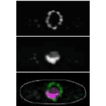 Immunofluorescene staining of Nup98 in S. pombe cells with 2H10 antibody.