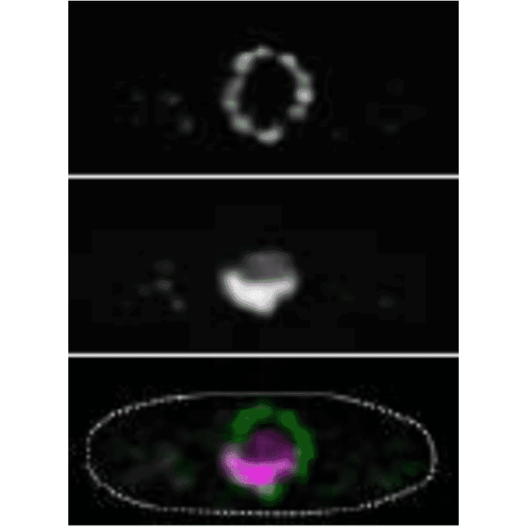 Immunofluorescence staining of nucleoporin in S. cereviciae cell with 2H10 antibody