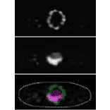 Immunofluorescence staining of nucleoporin in S. cereviciae cell with 2H10 antibody