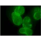 Immunofluorescent staining of HeLa cells with antibody R4C8.